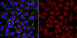 MilliporeSigma Rabbit anti-TERT, Polyclonal, 100&mu;g:Antibodies, Polyclonal